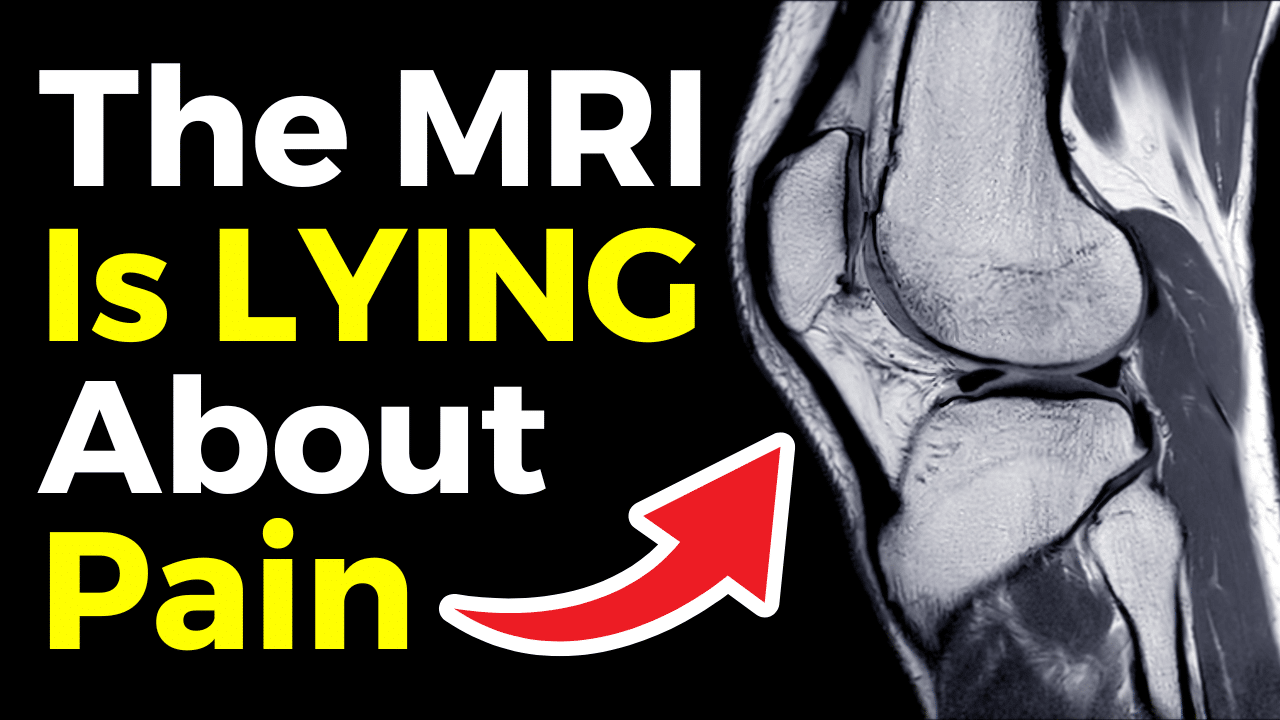 #1 Pain Myth – YT Thumbnail